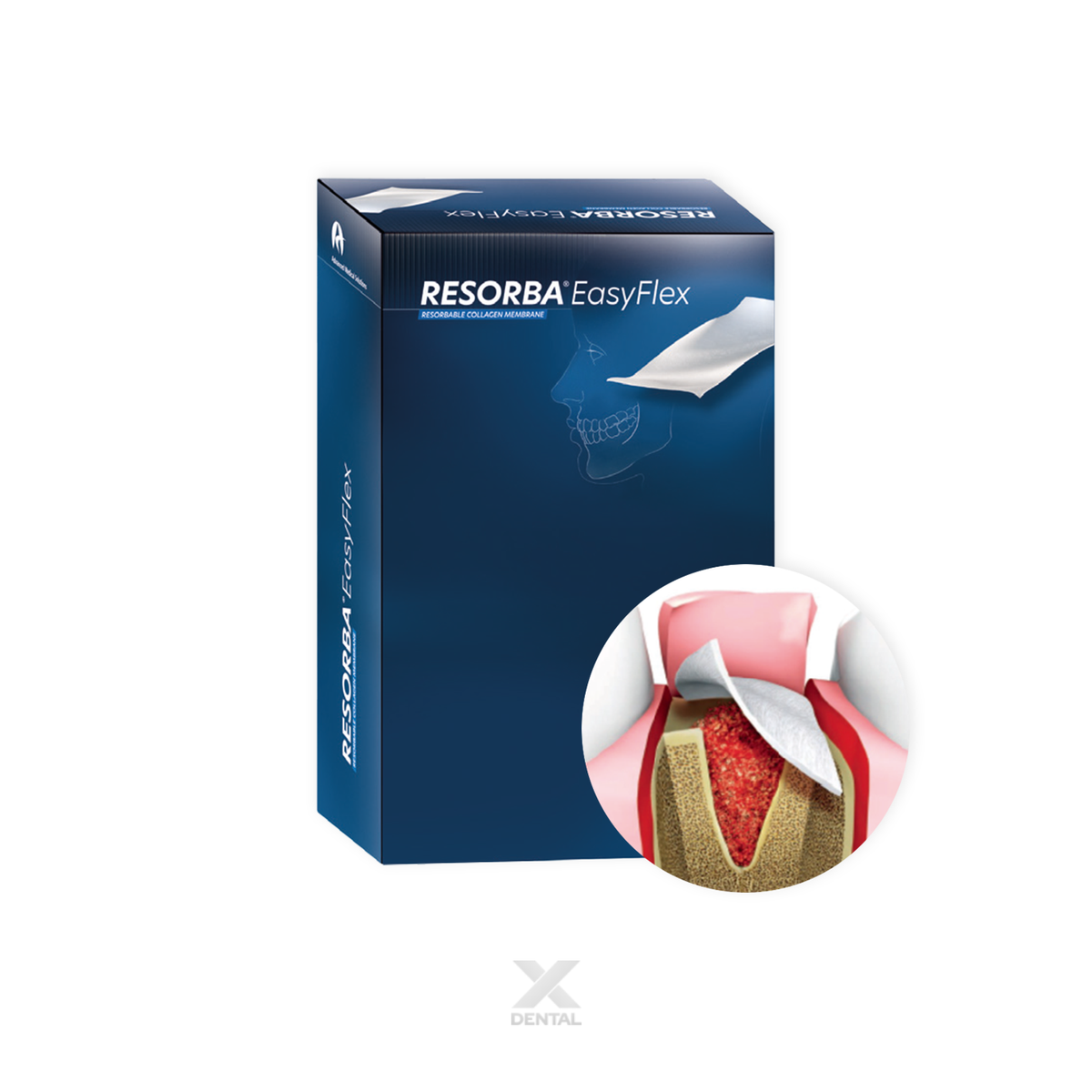 RESORBA® EasyFlex Porcine Collagen Membrane