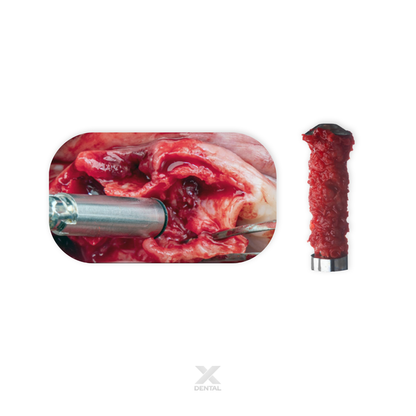 Bone Scraper & Handle